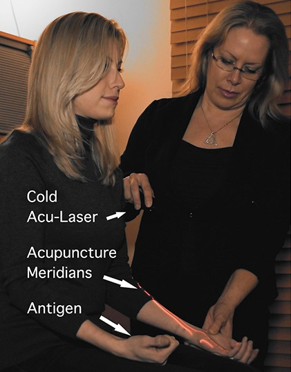 Carylann skillfully guides the Cold Acu-Laser along meridians. Client sits comfortably while holding an ampule containing antigen in her right hand.